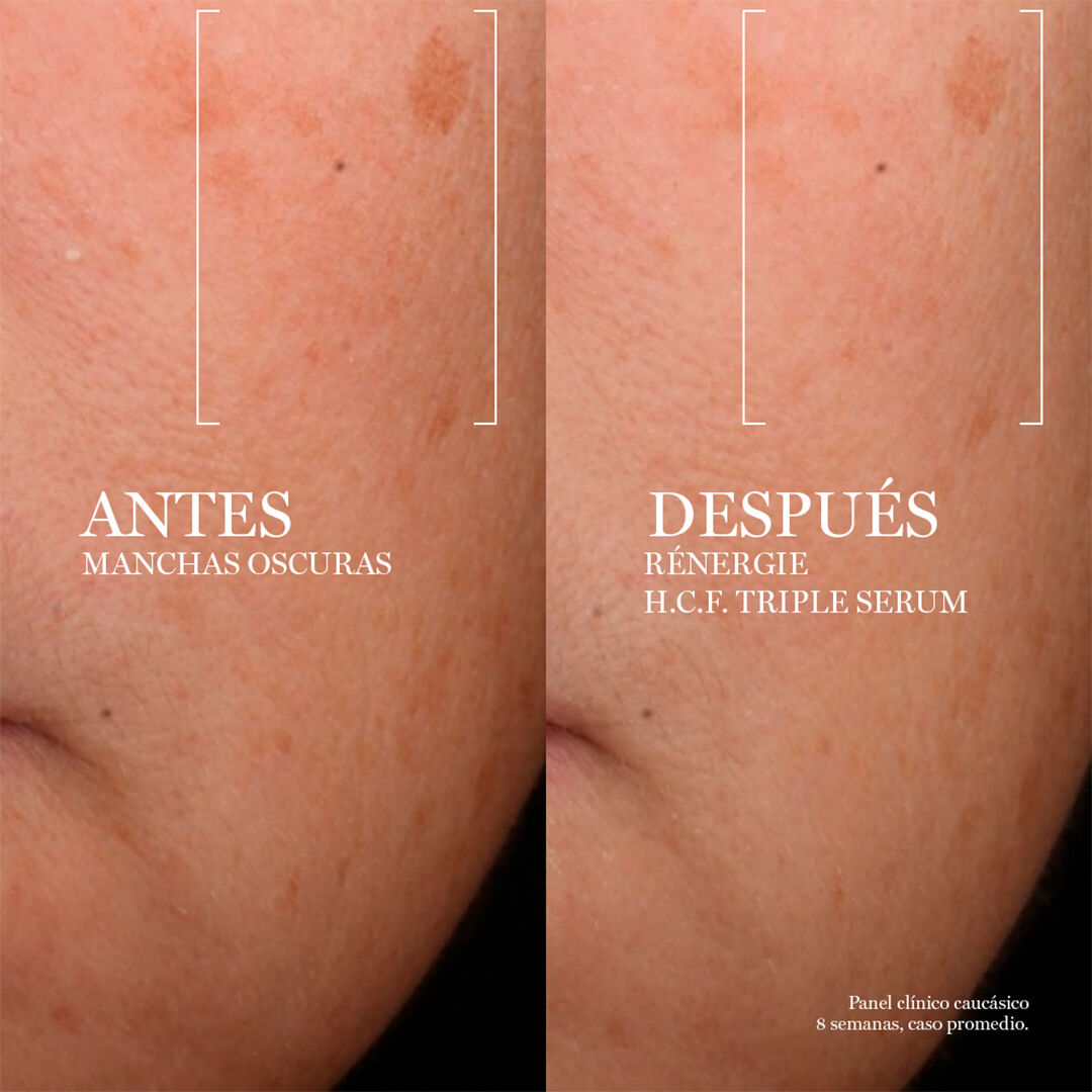 Renergie H.C.F. Triple Serum