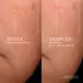 RENERGIE H.C.F. TRIPLE SERUM