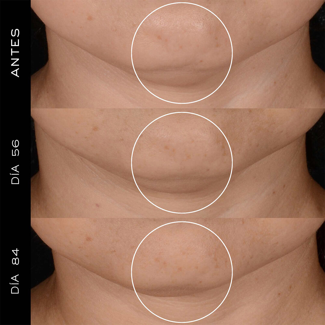 Renergie H.P.N. 300-Peptide Cream, Crema con Peptidos Regeneradora