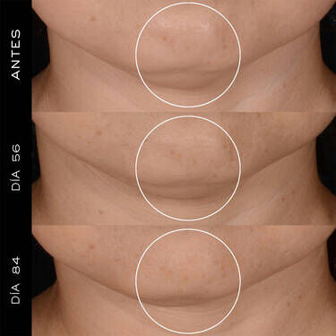 Renergie H.P.N. 300-Peptide Cream Kit con recarga